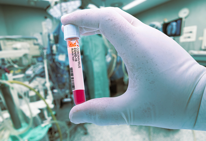 coronavirus_thumb_720_480